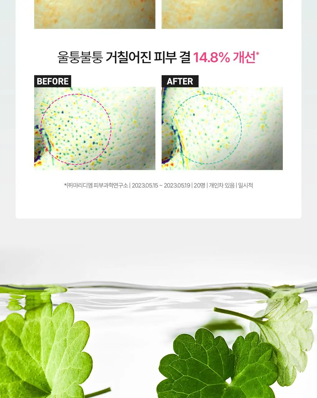 [7월올영픽/3일진정세럼]브링그린 징크테카 트러블 세럼 대용량 기획 상세페이지 33